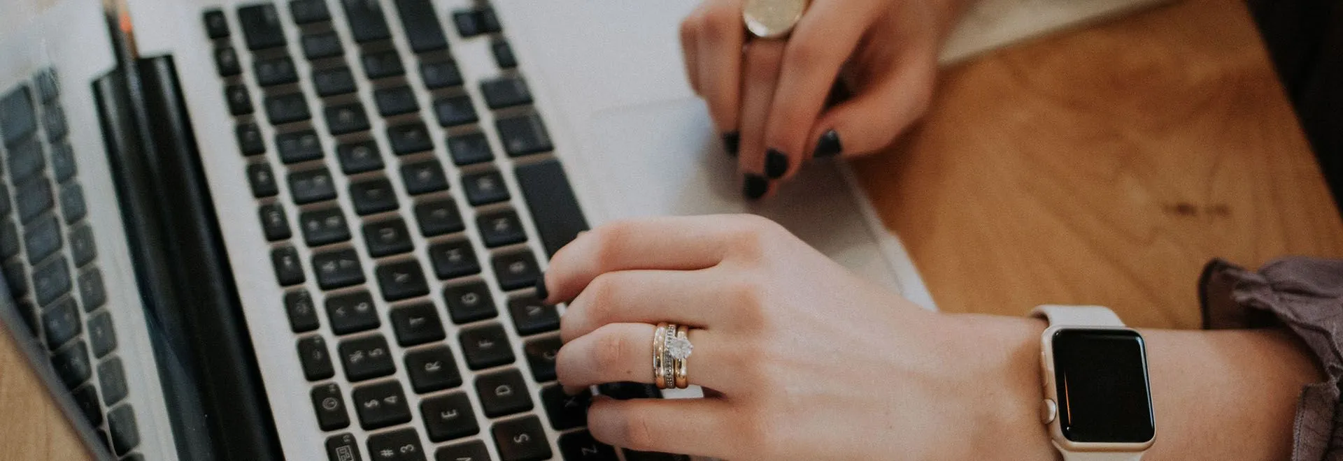 Person mit Smartwatch und Ringen tippt auf ihrem Macbook